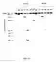 Fig. 25 - Tissue-specific and pathogen-specific toxic agents, ribozymes, dnazymes and antisense oligonucleotides, and methods of use thereof