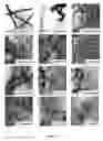 Fig. 08 - Treating neurodegenerative conditions