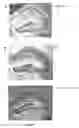 Fig. 19 - Treating neurodegenerative conditions