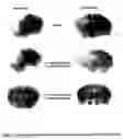 Fig. 06 - Methods of treatment utilizing certain melatonin derivatives
