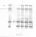 Fig. 02 - Process for selectively isolating IgY antibodies from egg yolk of an anseriform bird and IgY antibodies obtained thereby