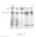 Fig. 04 - Process for selectively isolating IgY antibodies from egg yolk of an anseriform bird and IgY antibodies obtained thereby