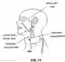 Fig. 09 - Apparatus and method for non-invasive and minimally-invasive sensing of venous oxygen saturation and pH levels