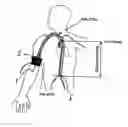 Fig. 01 - System and method for non-invasive cardiovascular assessment from supra-systolic signals obtained with a wideband external pulse transducer in a blood pressure cuff