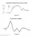 Fig. 06 - System and method for non-invasive cardiovascular assessment from supra-systolic signals obtained with a wideband external pulse transducer in a blood pressure cuff