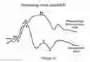 Fig. 07 - System and method for non-invasive cardiovascular assessment from supra-systolic signals obtained with a wideband external pulse transducer in a blood pressure cuff