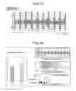 Fig. 10 - Heartbeat measuring apparatus