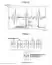 Fig. 14 - Heartbeat measuring apparatus