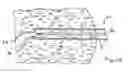 Fig. 16 - Methods and devices for removing tissue from a patient and placing a marker in the patient