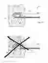 Fig. 20 - Methods and devices for removing tissue from a patient and placing a marker in the patient