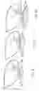 Fig. 05 - Massaging apparatus