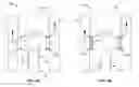 Fig. 06 - Hemodialysis access with on-off functionality