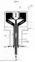 Fig. 07 - SUBARACHNOID EPIDURAL SHUNT