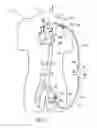 Fig. 07 - Methods for minimally invasive vascular access