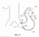 Fig. 09 - Methods for minimally invasive vascular access