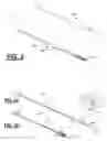 Fig. 03 - Scored catheter device