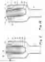 Fig. 08 - Surgical access device with pendent valve