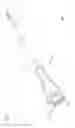 Fig. 02 - MEDICAL DEVICE HAVING RELEASABLE RETAINER