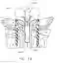 Fig. 22 - Anchors for use in anastomotic procedures
