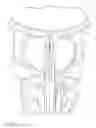 Fig. 02 - Harness and balloon catheter assembly and method for use in anastomosis procedures