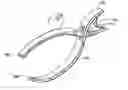 Fig. 01 - Surgical marker clip and method for cholangiography