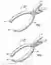 Fig. 02 - Surgical marker clip and method for cholangiography
