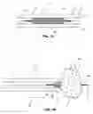 Fig. 02 - Expandable medical retrieval device and related methods of use