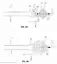 Fig. 06 - Expandable medical retrieval device and related methods of use
