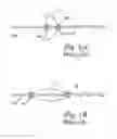 Fig. 02 - Vascular protection devices and methods of use