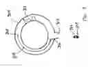Fig. 04 - Method and apparatus to terminate ventricular tachycardia via pacing