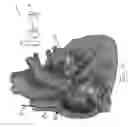 Fig. 08 - System and method for improving pacing parameters using acute hemodynamic feedback during device implant