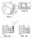 Fig. 02 - Neural electrode array
