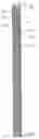 Fig. 01 - Stent and stent delivery device