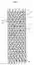Fig. 08 - Stent and stent delivery device