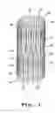 Fig. 02 - Neurovascular stent and method