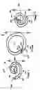 Fig. 02 - Removable coiled stent