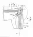 Fig. 03 - Elbow prosthesis