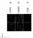 Fig. 15 - Protein fragment complementation assays for high-throughput and high-content screening