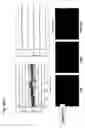 Fig. 18 - Protein fragment complementation assays for high-throughput and high-content screening