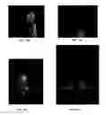 Fig. 16 - Method and system for graphical hairstyle generation using statistical wisp model and pseudophysical approaches
