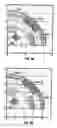 Fig. 07 - Force-balanced roller-cone bits, systems, drilling methods, and design methods