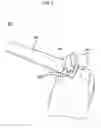 Fig. 03 - Napkin holder