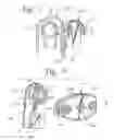 Fig. 04 - Clips for mounting accessories to play yards and methods of operating the same