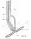 Fig. 16 - Cleaning device