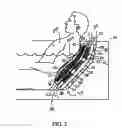Fig. 03 - Methodology and apparatus for a flexible back exfoliator