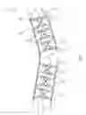 Fig. 02 - Tire chain assembly having a tension adjustment function