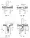 Fig. 03 - Needling loops into carrier sheets