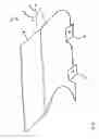 Fig. 02 - Rain gutter guard