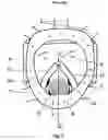 Fig. 02 - Breathing mask