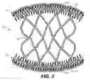 Fig. 04 - Stretch comb hair retainer